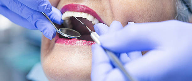 Best Emergency Dental Care for Broken or Chipped Teeth in Wading River, NY